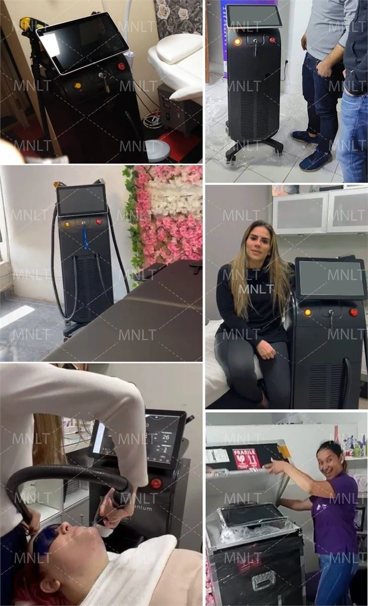 Diode Laser 808nm Hair Removal