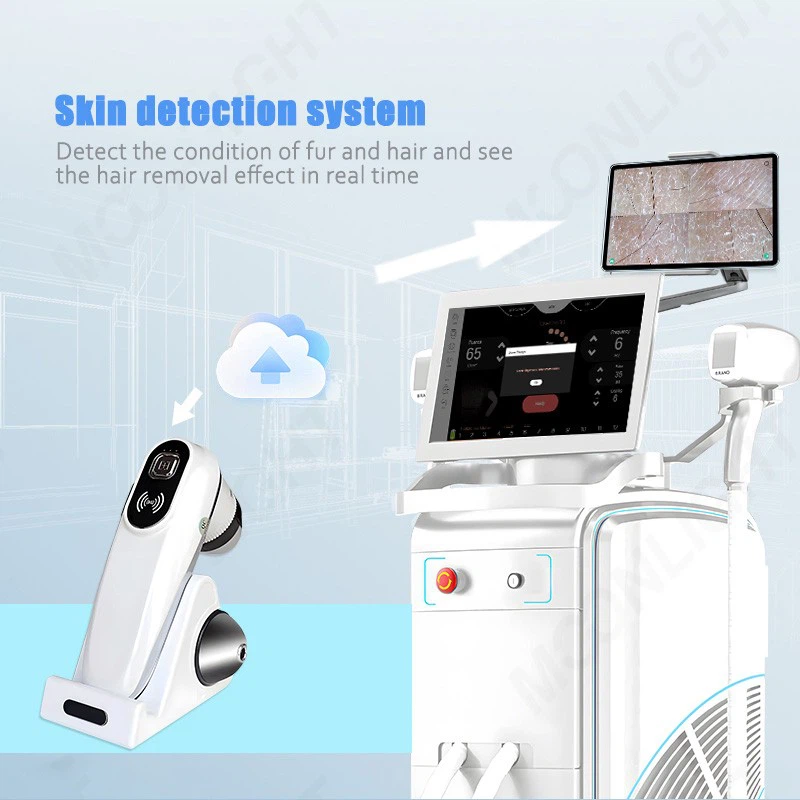 2000w Diode Laser Hair Removal Machine