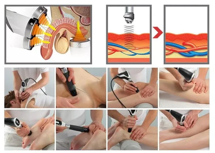 Shock Wave Therapy Machine